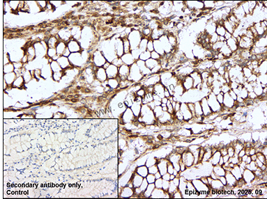Anti-MAP4K1/HPK1 Rabbit mAb [52R32J96]