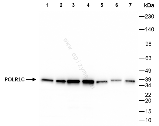 Anti-POLR1C Rabbit mAb [92F65Q60]