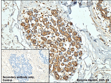 Anti-TRADD Rabbit mAb [59Q72E33]