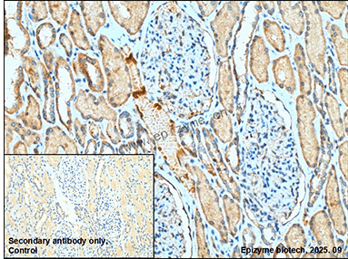 Anti-TRADD Rabbit mAb [59Q72E33]