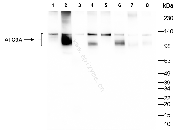 Anti-ATG9A Rabbit mAb [36G03F07]
