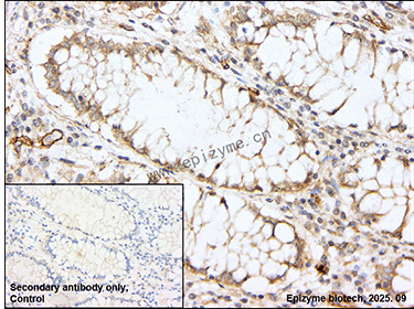 Anti-ATG9A Rabbit mAb [36G03F07]