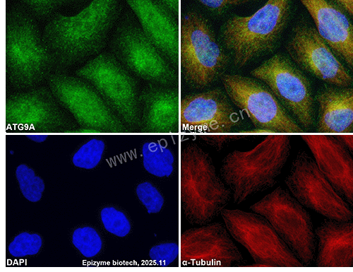 Anti-ATG9A Rabbit mAb [36G03F07]