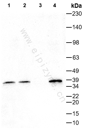 Anti-Phospho-IKB alpha (Ser32) Rabbit mAb [99I18M73]