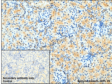 Anti-Phospho-CRK (Tyr221) Rabbit mAb [12L43F75]