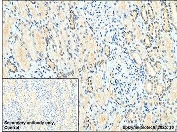 Anti-PAX8 Rabbit mAb [31T15J67]
