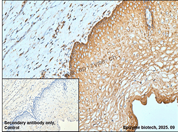 Anti-PKA RII alpha Rabbit mAb [73N94I80]