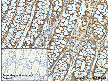 Anti-PKA RII alpha Rabbit mAb [73N94I80]
