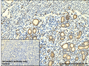 Anti-PTEN Rabbit mAb [70K11E55]
