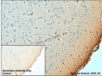 Anti-Tau 4R Rabbit mAb [67K76M08]