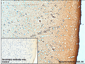 Anti-Tau 4R Rabbit mAb [67K76M08]