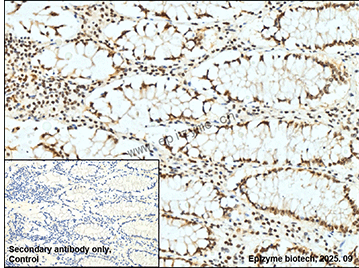 Anti-TERF2 Rabbit mAb [22B86P65]