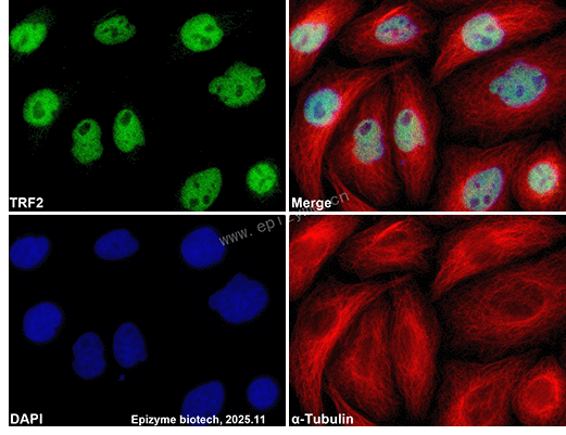 Anti-TERF2 Rabbit mAb [22B86P65]