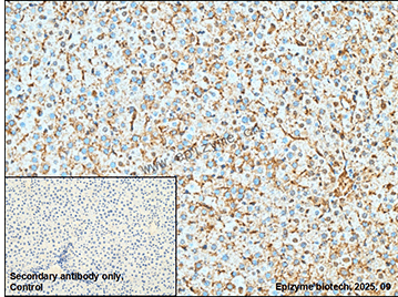 Anti-AGL Rabbit mAb [11R48S69]