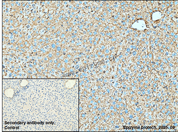 Anti-AGL Rabbit mAb [11R48S69]
