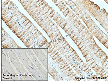 Anti-AGL Rabbit mAb [11R48S69]