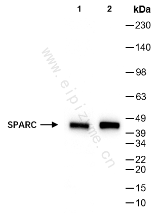 Anti-SPARC Rabbit mAb [64N44E33]