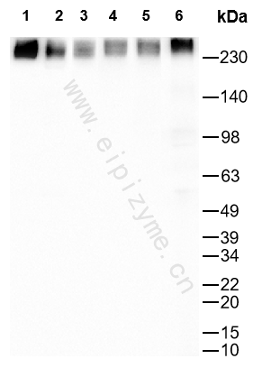 Anti-Acetyl Coenzyme A carboxylase alpha Rabbit mAb [62K63Q52]