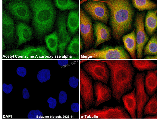 Anti-Acetyl Coenzyme A carboxylase alpha Rabbit mAb [62K63Q52]