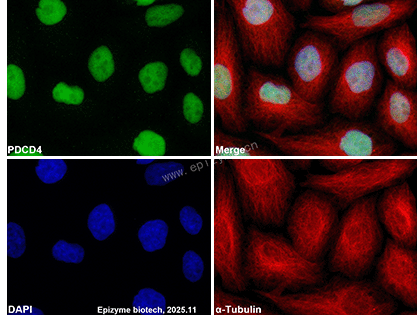 Anti-PDCD4 Rabbit mAb [83L86M98]