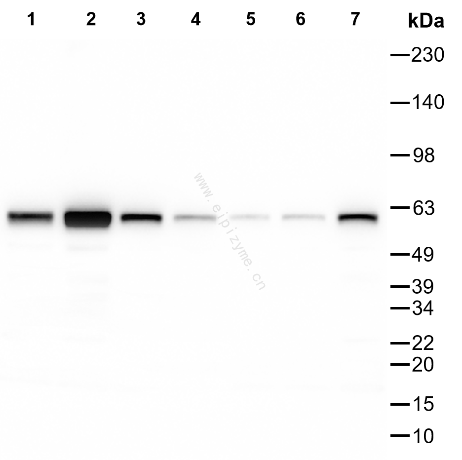 Anti-PDCD4 Rabbit mAb [83L86M98]