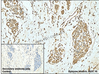 Anti-PIK3CA Mouse mAb [95R97F38]