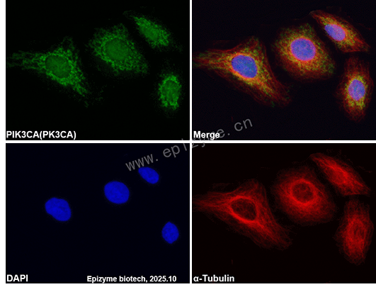 Anti-PIK3CA Mouse mAb [95R97F38]