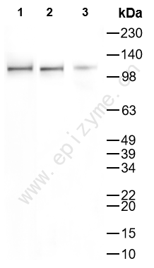 Anti-Notch1 Mouse mAb [61A89Q41]