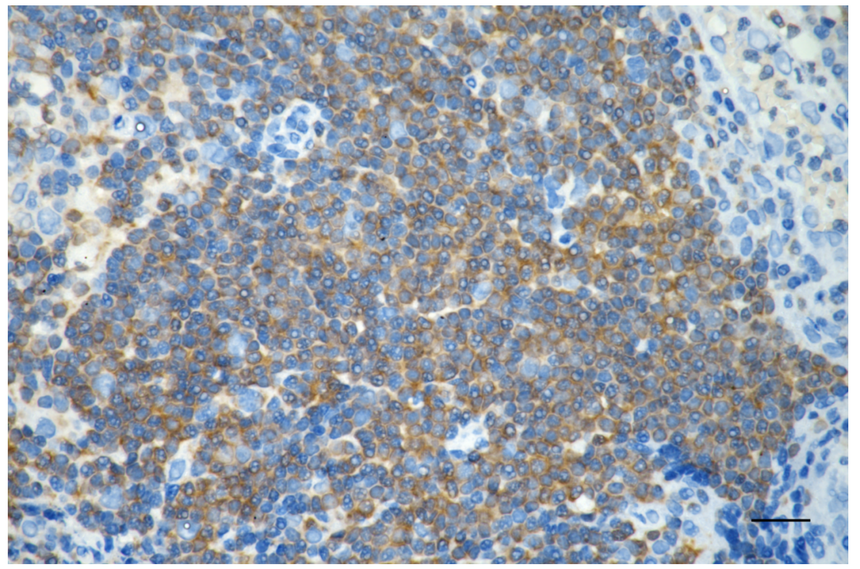 [KO Validated] Anti-PTPN6 Mouse mAb [13C48M10]