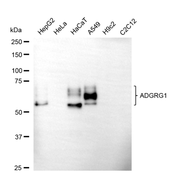 [KD Validated] Anti-ADGRG1 Mouse mAb [91D53G90]