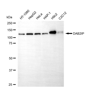 [KD Validated] Anti-DAB2IP Mouse mAb [63J74A34]