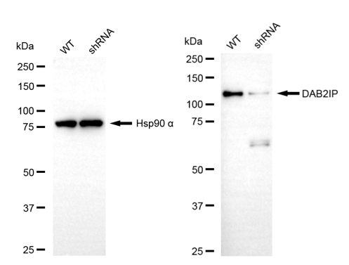 [KD Validated] Anti-DAB2IP Mouse mAb [63J74A34]