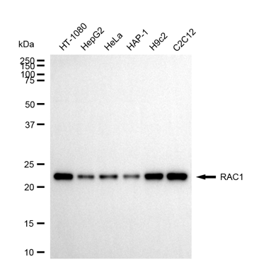 [KD Validated] Anti-RAC1 Mouse mAb [56E58F01]