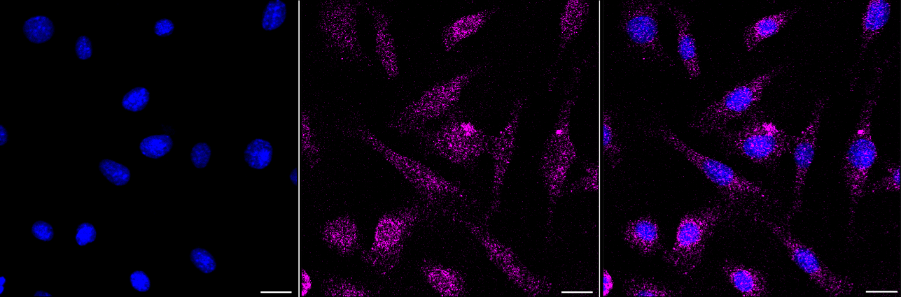 [KD Validated] Anti-AKT2 Mouse mAb [57T56N15]