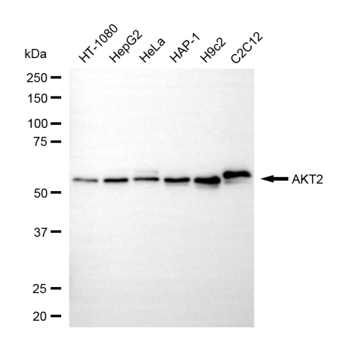 [KD Validated] Anti-AKT2 Mouse mAb [57T56N15]