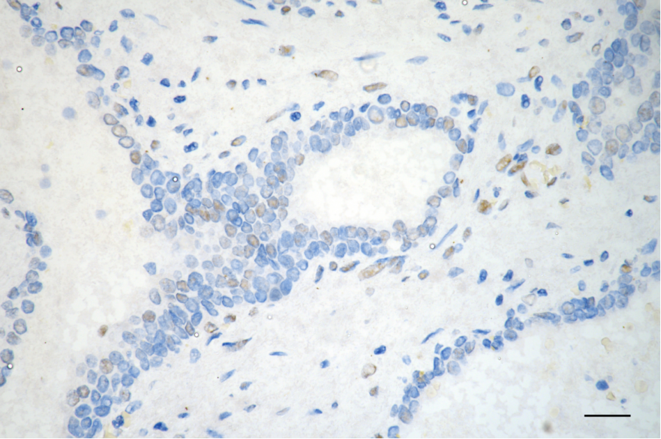 [KD Validated] Anti-PML Mouse mAb [60T10G29]