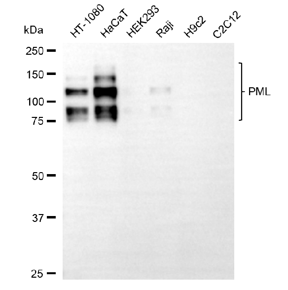 [KD Validated] Anti-PML Mouse mAb [60T10G29]