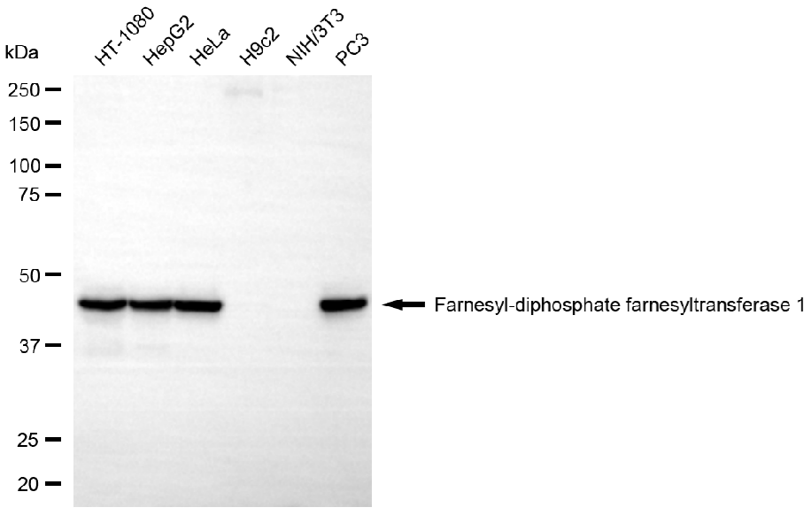 [KD Validated] Anti-FDFT1 Mouse mAb [49J77H29]
