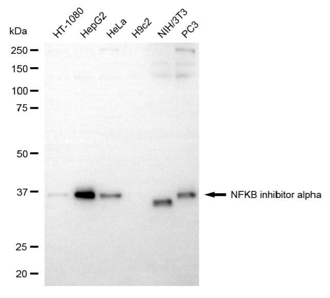 [KD Validated] Anti-NFKBIA Mouse mAb [19R71G40]