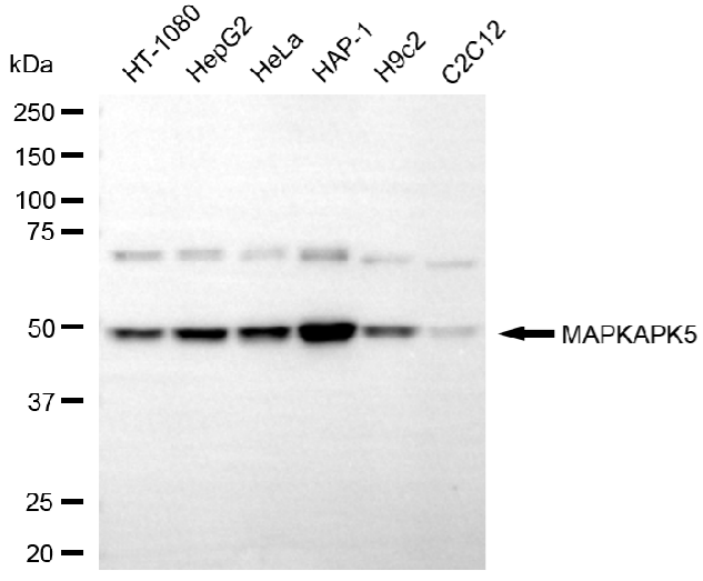 [KD Validated] Anti-MAPKAPK5 Mouse mAb [18S12S90]
