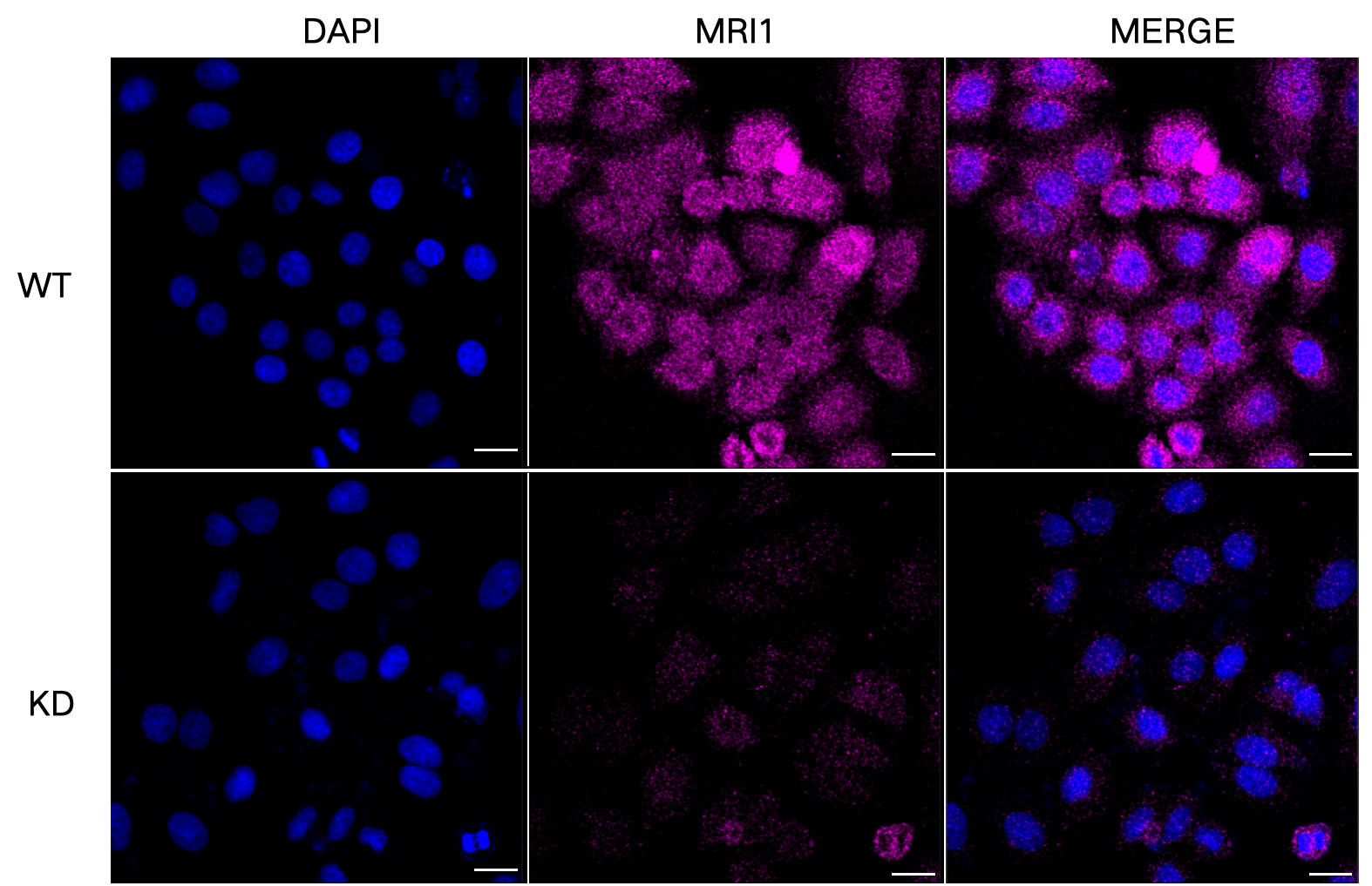 [KD Validated] Anti-MRI1 Mouse mAb [58G77Q16]