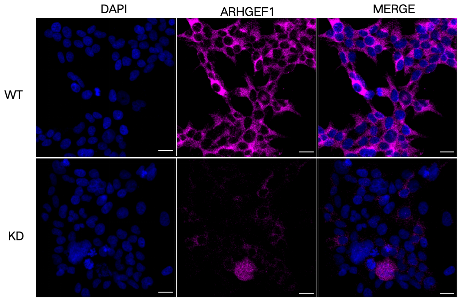 [KD Validated] Anti-ARHGEF1 Mouse oAb