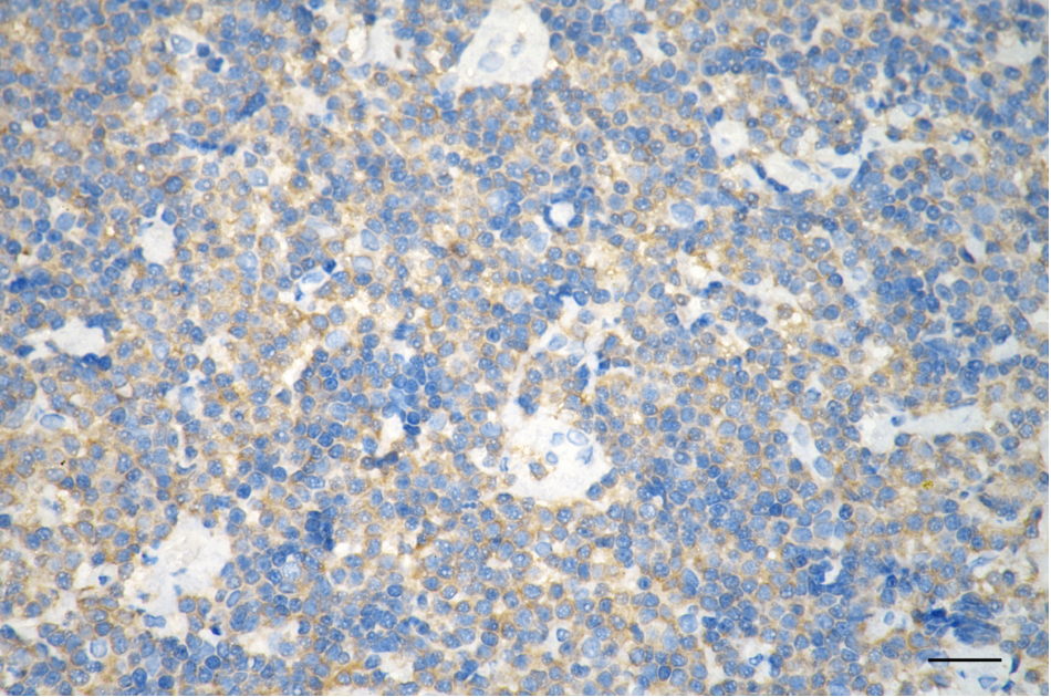 [KD Validated] Anti-ARHGEF1 Mouse oAb