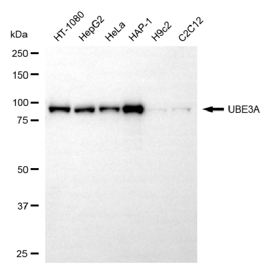 [KD Validated] Anti-UBE3A Mouse mAb [55K42K03]