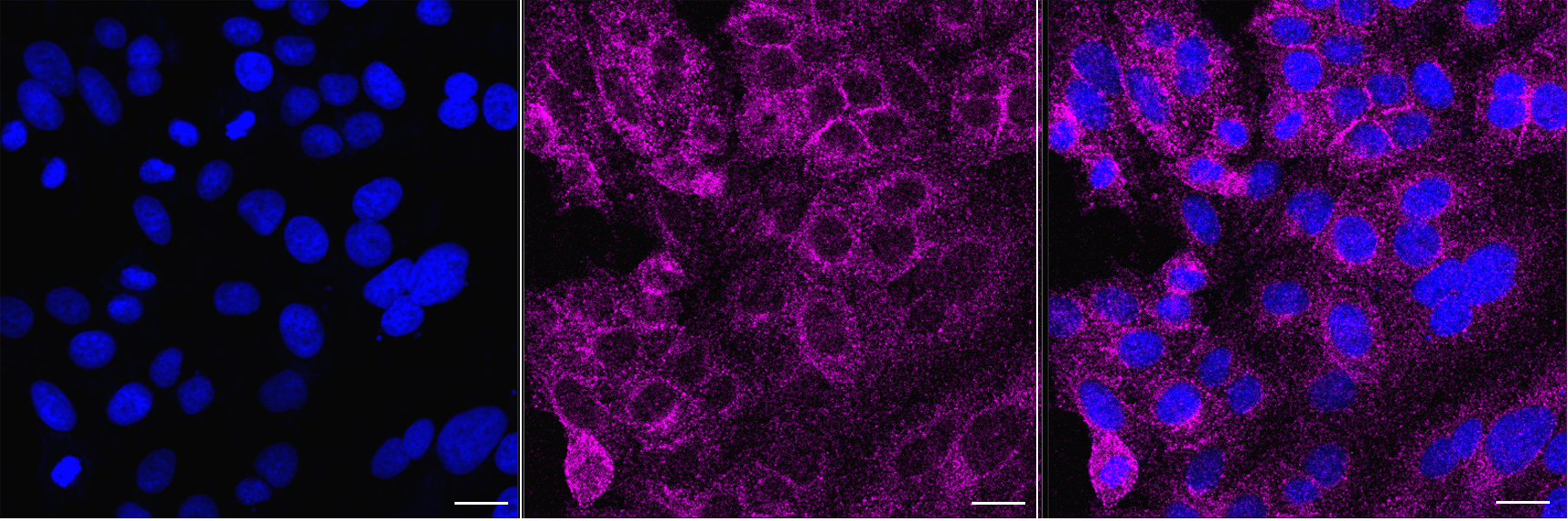 [KD Validated] Anti-PIK3C2A Mouse mAb [63K55S52]