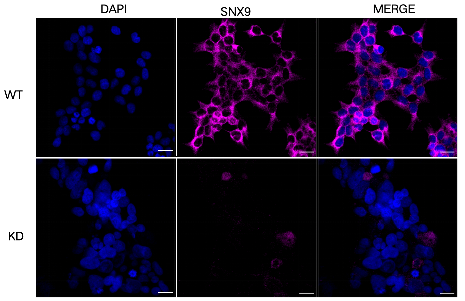 [KD Validated] Anti-SNX9 Mouse mAb [73B41B63]