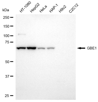 [KD Validated] Anti-GBE1 Mouse mAb [15E43S34]