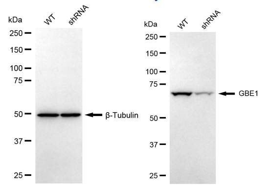 [KD Validated] Anti-GBE1 Mouse mAb [15E43S34]