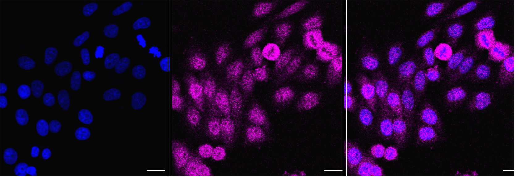 [KD Validated] Anti-EXOSC1 Mouse mAb [23D54F40]