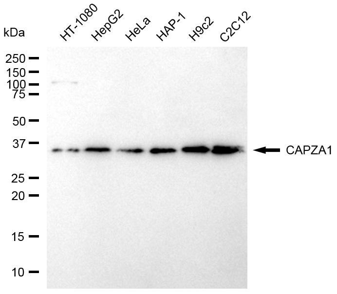 [KD Validated] Anti-CAPZA1 Mouse mAb [42D34H68]
